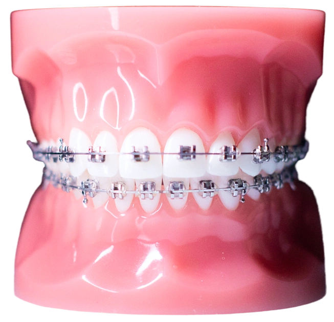 Orthodontic Treatment Special