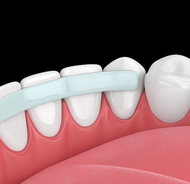 Dentist performing cosmetic bonding to repair and enhance a patient's smile.